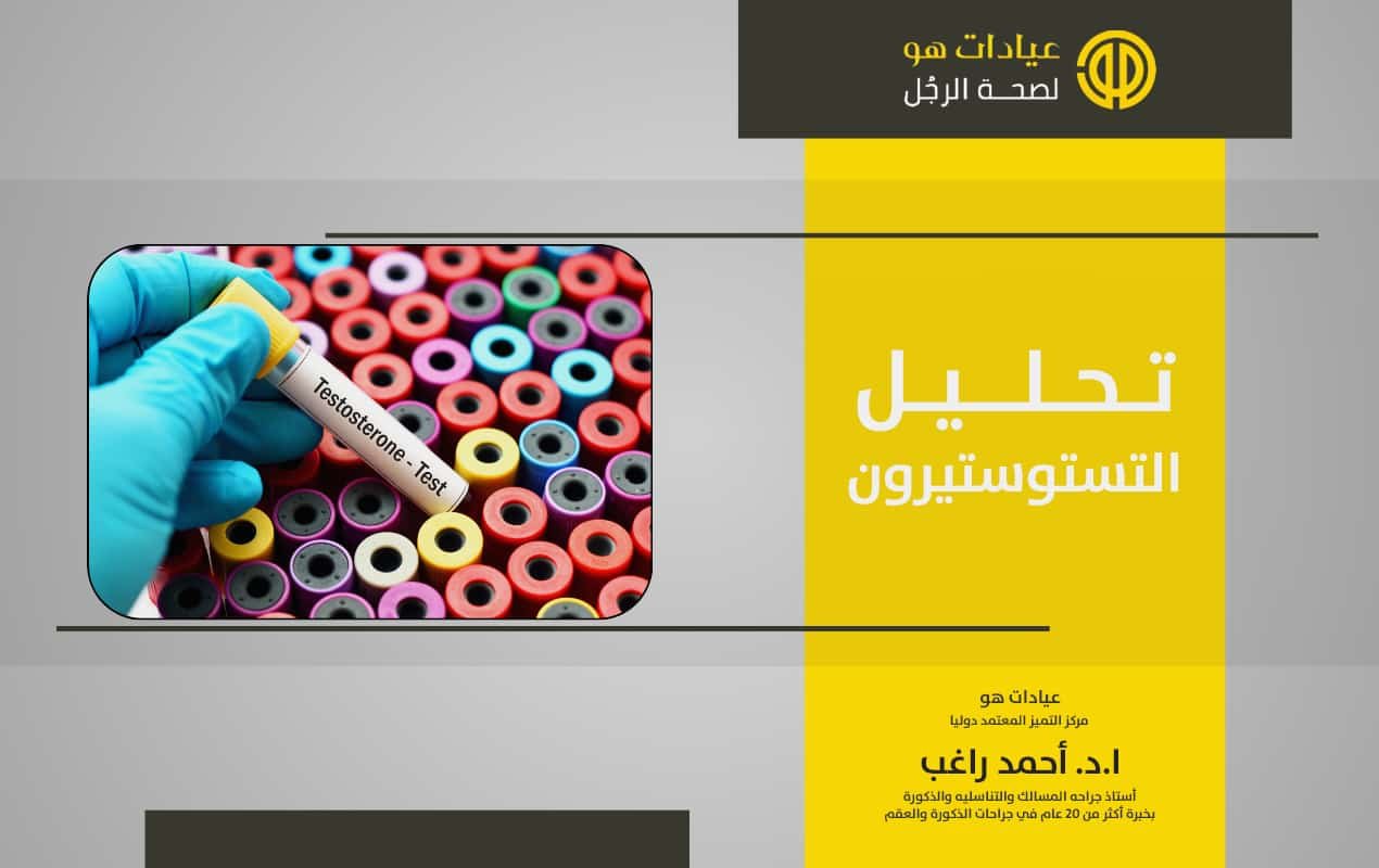 تحليل التستوستيرون